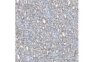 IHC analysis of SF3B3 using anti-SF3B3 antibody (ABIN7602378).