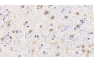 Detection of TNFa in Mouse Cerebrum Tissue using Polyclonal Antibody to Tumor Necrosis Factor Alpha (TNFa)