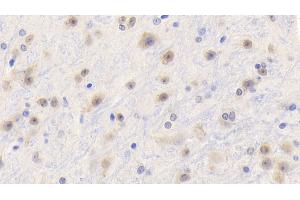 Detection of TNFa in Mouse Cerebrum Tissue using Polyclonal Antibody to Tumor Necrosis Factor Alpha (TNFa) (TNF alpha anticorps  (AA 80-235))