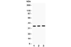 Western blot testing of Nkx2-5 antibody and Lane 1:  mouse spleen;  2: mouse heart;  3: human HeLa lysate. (NK2 Homeobox 5 anticorps  (Middle Region))