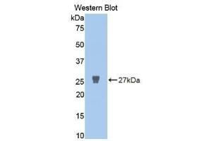 Detection of Recombinant MMP2, Human using Polyclonal Antibody to Matrix Metalloproteinase 2 (MMP2) (MMP2 anticorps  (AA 445-660))