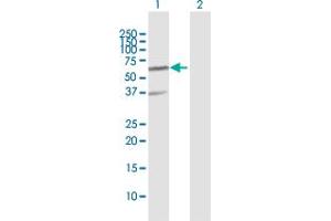 Western Blot analysis of RNF25 expression in transfected 293T cell line by RNF25 MaxPab polyclonal antibody.