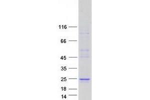 Validation with Western Blot