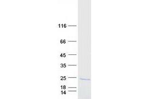 Validation with Western Blot