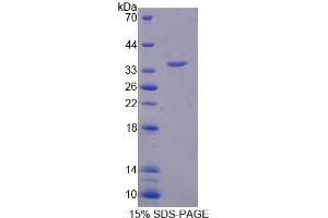 SDS-PAGE analysis of Human RFC2 Protein. (RFC2 Protéine)