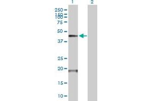 Western Blot analysis of TMPRSS11D expression in transfected 293T cell line by TMPRSS11D MaxPab polyclonal antibody. (TMPRSS11D anticorps  (AA 1-418))