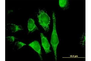 Immunofluorescence of purified MaxPab antibody to PDCD8 on HeLa cell. (AIF anticorps  (AA 1-613))