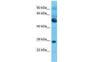 Host:  Rabbit  Target Name:  SLC13A5  Sample Type:  Thymus Tumor lysates  Antibody Dilution:  1.