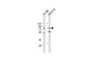 All lanes : Anti-CBFA2T3 Antibody at 1:500-1:2000 dilution Lane 1: HL-60 whole cell lysate Lane 2: MOLT-4 whole cell lysate Lysates/proteins at 20 μg per lane. (CBFA2T3 anticorps  (AA 418-653))