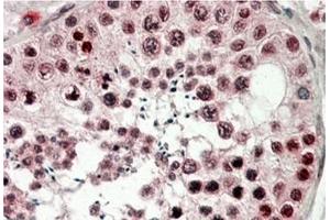 AP21512PU-N CIRBP antibody staining of paraffin embedded Human Testis at 3. (CIRBP anticorps  (C-Term))