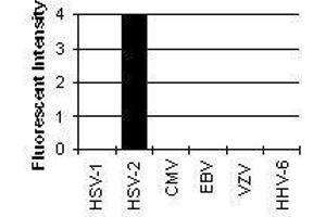 Cross Reactivity Results determined by IFA (HSV2 ICP8 anticorps)