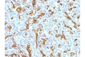 Formalin-fixed, paraffin-embedded human pancreas stained with Cytokeratin 19 antibody (KRT19/799 + KRT19/800)