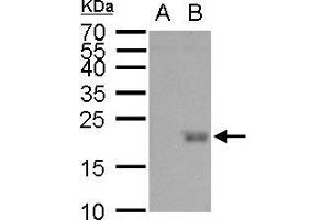 WB Image UBE2B antibody detects UBE2B protein by western blot analysis. (UBE2B anticorps)