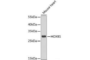 Western blot analysis of extracts of Mouse heart using HOXB1 Polyclonal Antibody at dilution of 1:1000. (HOXB1 anticorps)