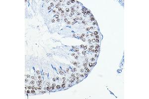 Immunohistochemistry of paraffin-embedded rat testis using FOSL1 Rabbit pAb (ABIN6131653, ABIN6140738, ABIN6140739 and ABIN6221016) at dilution of 1:100 (40x lens).