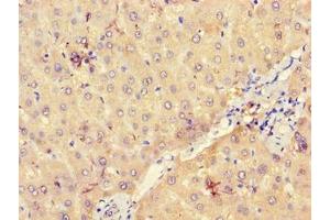 Immunohistochemistry of paraffin-embedded human liver tissue using ABIN7175166 at dilution of 1:100 (UGP2 anticorps  (AA 1-497))