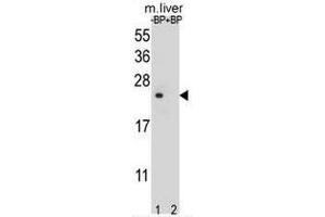 Western blot analysis of T4S4 Antibody (N-term) Pab pre-incubated without(lane 1) and with(lane 2) blocking peptide in liver cell line lysate. (TM4SF4 anticorps  (N-Term))