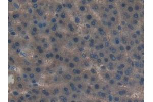 Detection of LIFR in Rat Liver Tissue using Polyclonal Antibody to Leukemia Inhibitory Factor Receptor (LIFR)