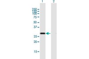 Western Blot analysis of CIP29 expression in transfected 293T cell line by CIP29 MaxPab polyclonal antibody. (SARNP anticorps  (AA 1-210))