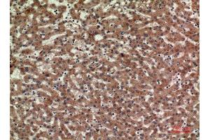 Immunohistochemistry (IHC) analysis of paraffin-embedded Human Liver, antibody was diluted at 1:100. (CD3D anticorps  (Internal Region))