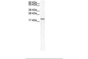 Image no. 1 for anti-Chemokine (C-X-C Motif) Ligand 14 (CXCL14) (C-Term) antibody (ABIN202018) (CXCL14 anticorps  (C-Term))