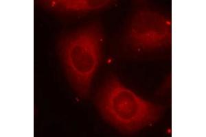 Immunofluorescence staining of methanol-fixed Hela cells using LIMK2(Phospho-Thr505) Antibody.