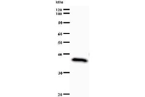 Western Blotting (WB) image for anti-Set1/Ash2 Histone Methyltransferase Complex Subunit ASH2 (ASH2L) antibody (ABIN933109) (ASH2L anticorps)
