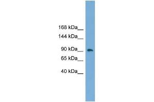 Human Placenta; WB Suggested Anti-ZNF226 Antibody Titration: 0. (ZNF226 anticorps  (Middle Region))