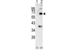 Image no. 2 for anti-Bone Morphogenetic Protein 3 (BMP3) (N-Term) antibody (ABIN357181) (BMP3 anticorps  (N-Term))