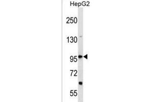 DHX36 Antikörper  (AA 394-420)