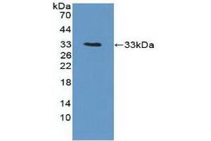 Detection of Recombinant PTK6, Human using Polyclonal Antibody to Protein Tyrosine Kinase 6 (PTK6)