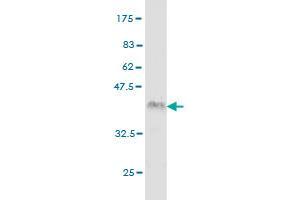 Western Blot detection against Immunogen (36. (IRAK2 anticorps  (AA 111-210))