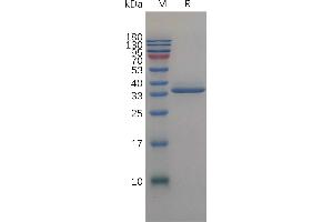 Human IG Protein, His Tag on SDS-PAGE under reducing condition.