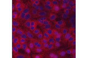 IF analysis of SCYL2 using anti-SCYL2 antibody (ABIN7601804).