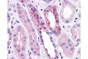 Anti-CASR/Calcium Sensing Receptor antibody IHC of human kidney, diabetes. (CASR anticorps  (N-Term))