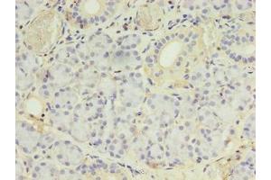 Immunohistochemistry of paraffin-embedded human pancreatic tissue using ABIN7142054 at dilution of 1:100 (PLCD4 anticorps  (AA 1-762))