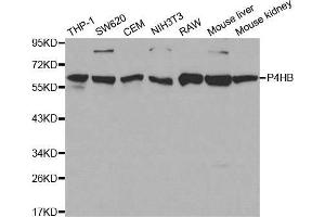 Western blot analysis of extracts of various cell lines, using P4HB antibody. (P4HB anticorps  (AA 329-508))