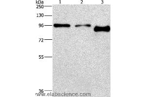 Western blot analysis of A431 and hela cell,mouse brain tissue, using PIP5K1C Polyclonal Antibody at dilution of 1:500 (PIP5K1C anticorps)
