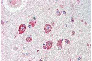 Human Brain, Cortex: Formalin-Fixed, Paraffin-Embedded (FFPE)