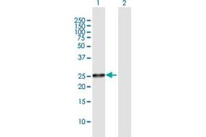 Western Blot analysis of FLJ22662 expression in transfected 293T cell line by FLJ22662 MaxPab polyclonal antibody. (FLJ22662 (AA 1-223) anticorps)