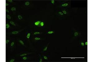 Immunofluorescence of purified MaxPab antibody to SFRS14 on HeLa cell. (SFRS14 anticorps  (AA 1-988))