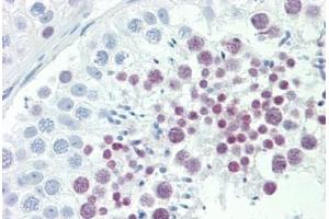 Human Testis: Formalin-Fixed, Paraffin-Embedded (FFPE)