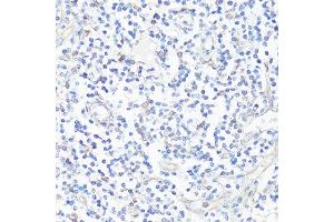 Immunohistochemistry of paraffin-embedded human tonsil using CASP3 antibody. (Caspase 3 anticorps  (AA 55-160))
