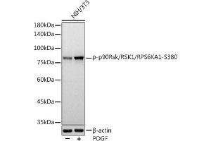 Western blot analysis of extracts of NIH/3T3 cells, using Phospho-p90Rsk/RSK1/RPS6K-S380 antibody (ABIN7270036) at 1:1000 dilution. (RPS6KA1 anticorps  (pSer380))