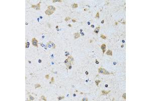 Immunohistochemistry of paraffin-embedded rat brain using PDP1 antibody (ABIN1980348) at dilution of 1:100 (40x lens). (PDP anticorps)
