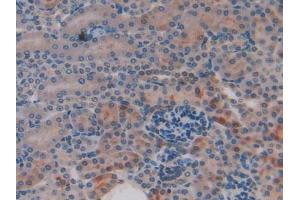 Figure. (CYR61 anticorps  (AA 176-379))