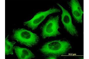 Immunofluorescence of monoclonal antibody to TUBA6 on HeLa cell.