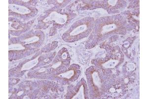 anti-PKA 2 beta (Center) antibody