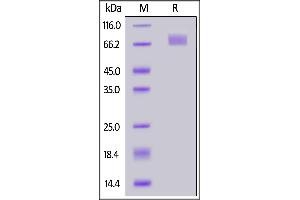 SARS-CoV-2 S2 protein (A701V), His Tag on  under reducing (R) condition. (SARS-CoV-2 Spike S2 Protein (B.1.351 - beta) (His tag))