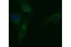 Image no. 3 for anti-Tubulin, beta 2A (TUBB2A) antibody (ABIN1501567)